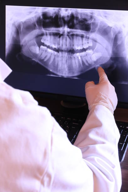 Best Emergency Wisdom Teeth Removal in Labasas, CA